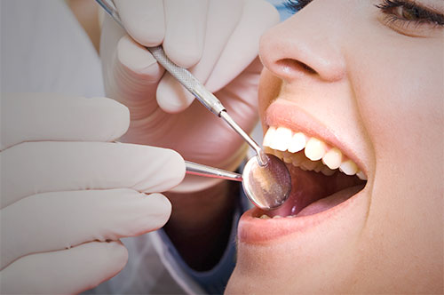 Professional Teeth Cleanings