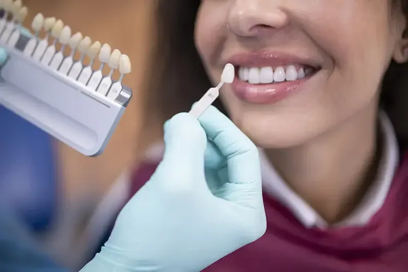 Blanqueamiento dental