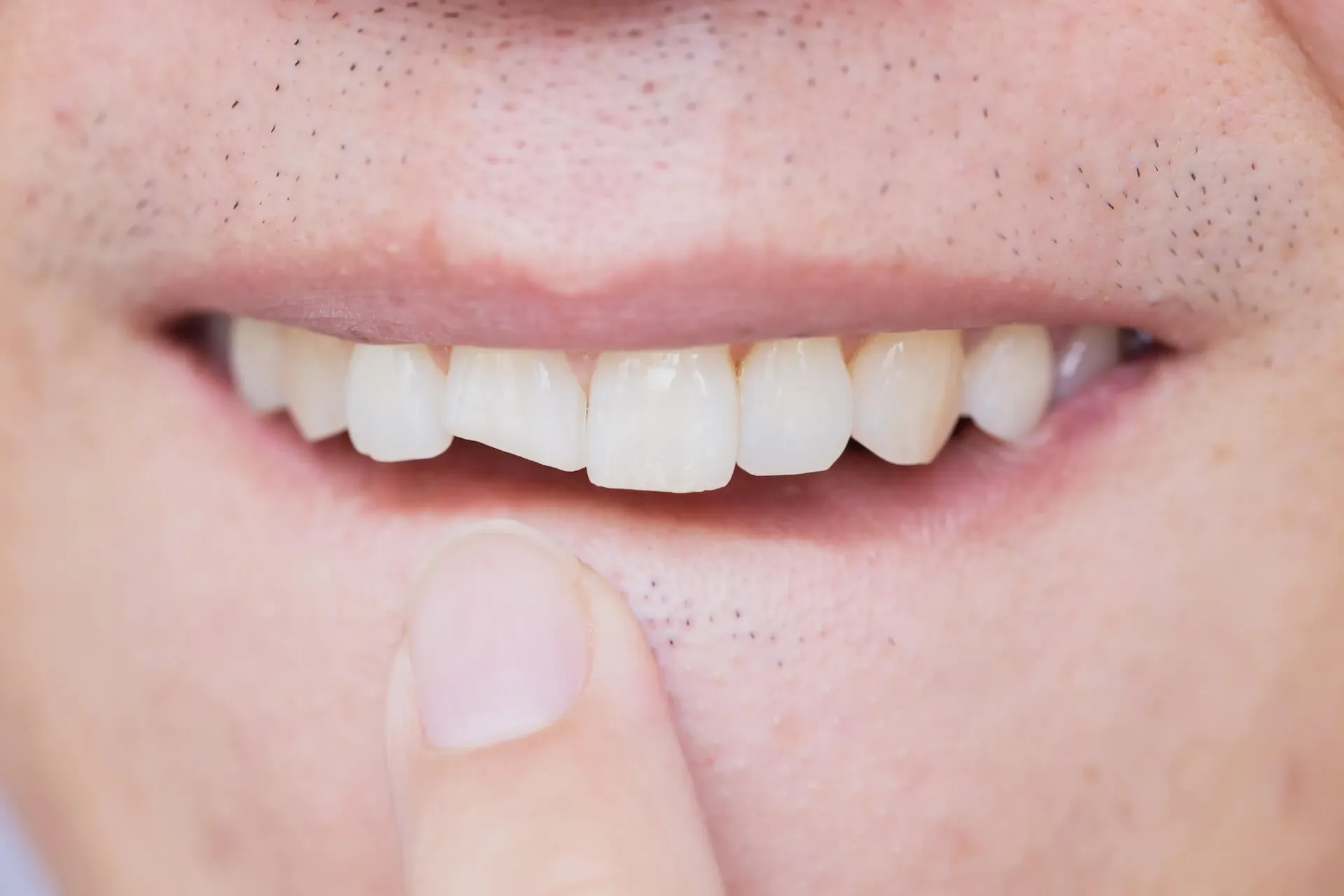 El costo del tratamiento de emergencias dentales