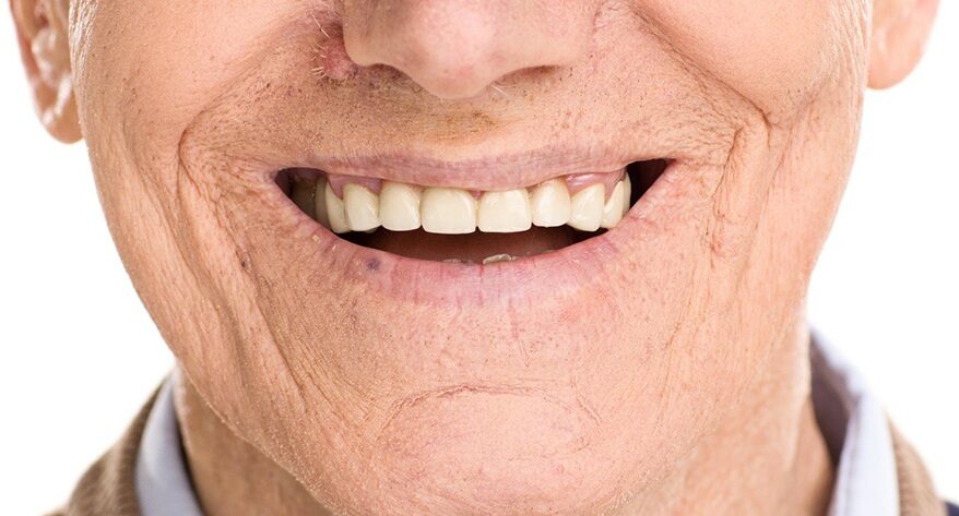 Dentures