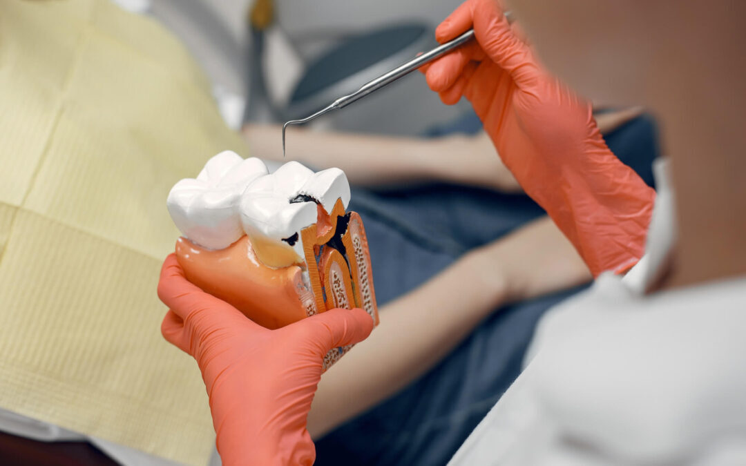 Radiation and Root Canals: Navigating Dental Care During Cancer Treatment
