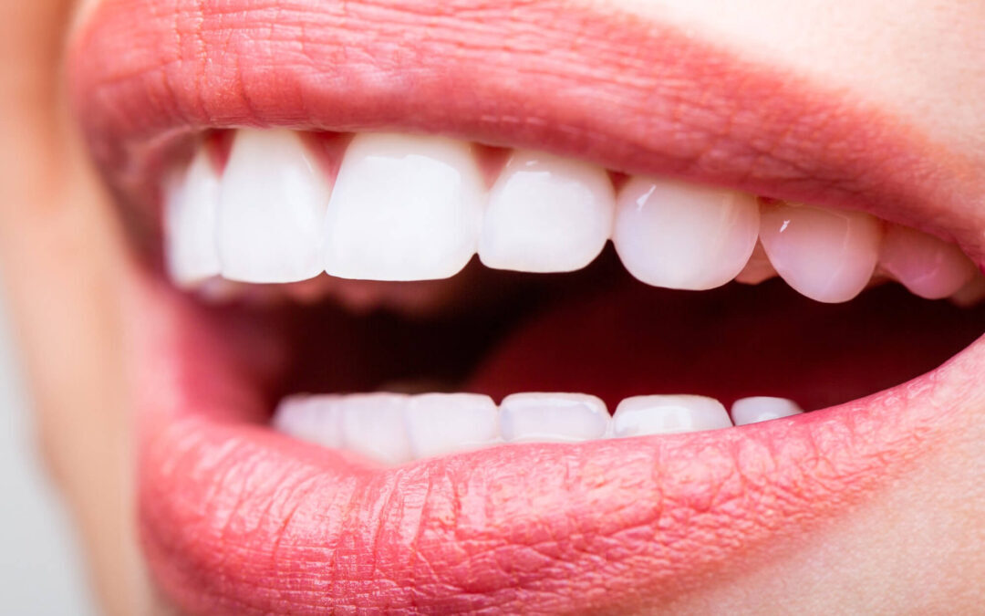 Stay Away Stains! How To Keep Teeth Shining Bright