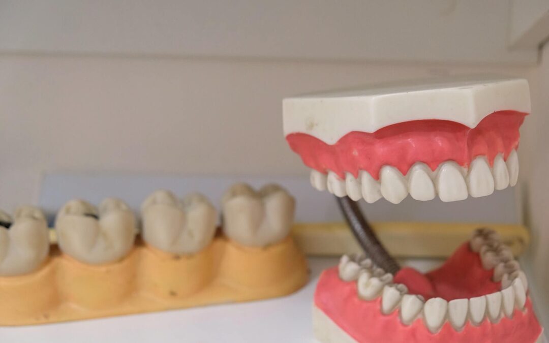 5 Reasons Why Dentures Could Be Right For You
